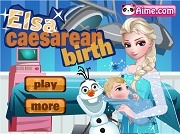 Игра Эльза рожает через Кесарево сечение
(англ. Elsa caesarean birth)