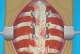 Игра Operate Now! Scoliosis Surgery